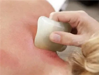 Como funciona a terapia Gua Sha